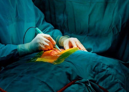 Best Laparoscopic Surgery Hospital in Ashok Vihar