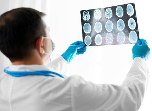 Best Neurology Specialist Hospital in North Delhi