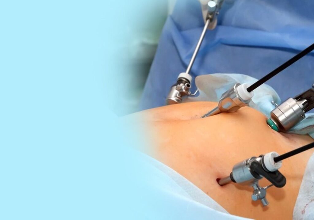Best Laparoscopic Surgeon in Pitampura